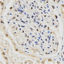 Small Nuclear Ribonucleoprotein E (SNRPE) Antibody