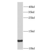 WB analysis of human placenta tissue, using SNRPE antibody (1/1000 dilution).