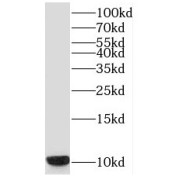 WB analysis of human heart tissue, using SNRPF antibody (1/500 dilution).
