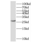 WB analysis of mouse brain tissue, using SNRPN antibody (1/800 dilution).