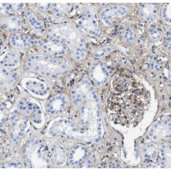 Sorting Nexin 5 (SNX5) Antibody