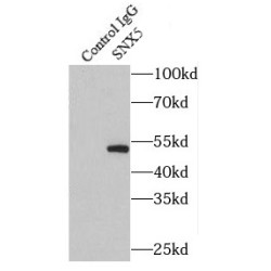 Sorting Nexin 5 (SNX5) Antibody