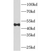 WB analysis of Jurkat cells, using SNX5 antibody (1/500 dilution).