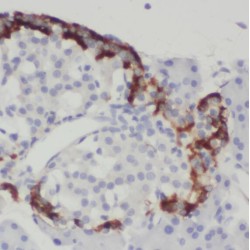 Sorting Nexin 7 (SNX7) Antibody