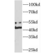 WB analysis of HeLa cells, using SNX7 antibody (1/300 dilution).