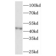 WB analysis of HeLa cells, using SOAT2 antibody (1/1000 dilution).