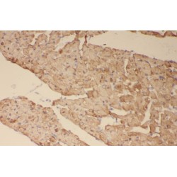 Suppressors of Cytokine Signaling 3 (SOCS3) Antibody