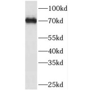 WB analysis of Jurkat cells, using SOLO antibody (1/1000 dilution).