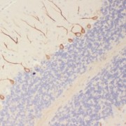 IHC-P analysis of human brain tissue, using SORLA antibody (1/50 dilution).