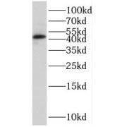 WB analysis of COLO 320 cells, using SOX7 antibody (1/600 dilution).