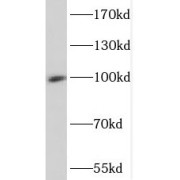 WB analysis of Jurkat cells, using SP100 antibody (1/400 dilution).