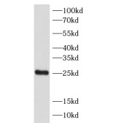 WB analysis of mouse testis tissue, using SPA17 antibody (1/400 dilution).