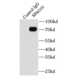 Sperm Associated Antigen 16 (SPAG16) Antibody