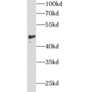 WB analysis of PC-3 cells, using SPAM1 antibody (1/1000 dilution).