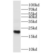 WB analysis of human testis tissue, using SPANXC antibody (1/300 dilution).