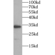 WB analysis of human placenta tissue, using SPARC antibody (1/1000 dilution).