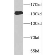 WB analysis of human heart tissue, using SPARCL1 antibody (1/400 dilution).