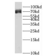 WB analysis of COLO 320 cells, using SPATA13 antibody (1/300 dilution).