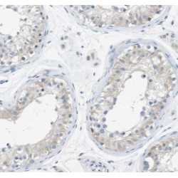 Spermatogenesis Associated 19 (SPATA19) Antibody