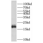 WB analysis of human testis tissue, using SPATA19 antibody (1/1000 dilution).