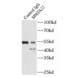 Spermatogenesis Associated 22 (SPATA22) Antibody