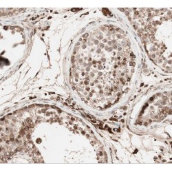 Spermatogenesis Associated 6 (SPATA6) Antibody