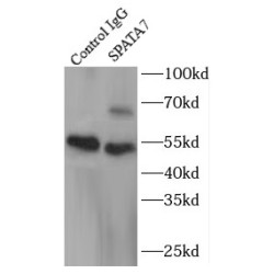 Spermatogenesis Associated 7 (SPATA7) Antibody