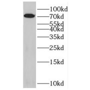 WB analysis of mouse testis tissue, using SPATA7 antibody (1/300 dilution).