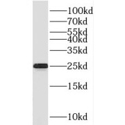 WB analysis of mouse spleen tissue, using SPCS2 antibody (1/1000 dilution).