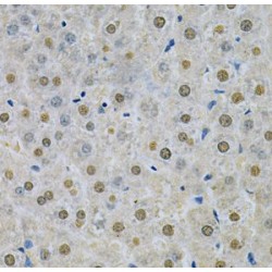 Sphingosine Kinase 1 (SPHK1) Antibody