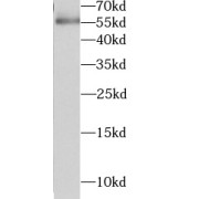 WB analysis of HeLa cells, using SPHK1 antibody (1/1000 dilution).