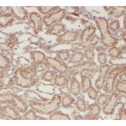 Sphingosine Kinase 2 (SPHK2) Antibody