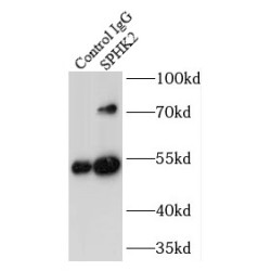 Sphingosine Kinase 2 (SPHK2) Antibody