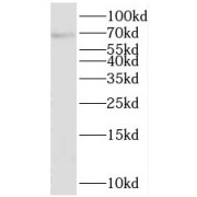 WB analysis of mouse cerebellum tissue, using SPHK2 antibody (1/300 dilution).