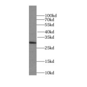 WB analysis of SKOV-3 cells, using SPIN1 antibody (1/500 dilution).