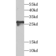 WB analysis of mouse brain tissue, using SPIN2B antibody (1/1000 dilution).