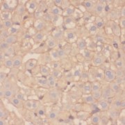 IHC-P analysis of human liver tissue, using SPINK9 Antibody (1/200 dilution).