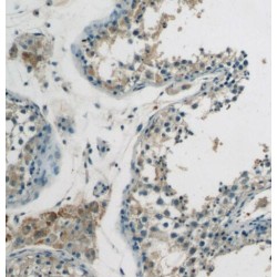 Sprouty Related EVH1 Domain Containing 2 (SPRED2) Antibody