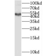 WB analysis of mouse testis tissue, using SPRED2 antibody (1/1000 dilution).