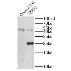 Small Proline Rich Protein 3 (SPRR3) Antibody
