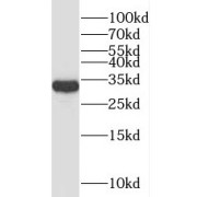 WB analysis of RAW264.7 cells, using SPRY3 antibody (1/600 dilution).