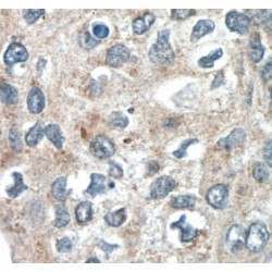 Sprouty RTK Signaling Antagonist 4 (SPRY4) Antibody