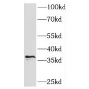 WB analysis of A375 cells, using SPRY4 antibody (1/1000 dilution).