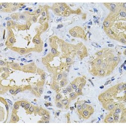 Serine Palmitoyltransferase, Long Chain Base Subunit 1 (SPTLC1) Antibody