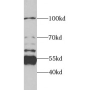 WB analysis of MCF7 cells, using SPTLC1 antibody (1/1000 dilution).