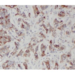 Squalene Monooxygenase (SQLE) Antibody