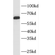 WB analysis of A549 cells, using SQLE antibody (1/300 dilution).