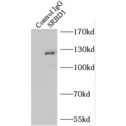 S1 RNA Binding Domain 1 (SRBD1) Antibody