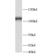 WB analysis of mouse testis tissue, using SRBD1 antibody (1/300 dilution).