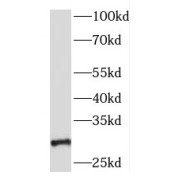 WB analysis of mouse testis tissue, using SRD5A1 antibody (1/1000 dilution).